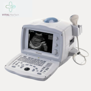 Mindray DP 1100 Plus Gray Sacle (Refurbished) Ultrasound Machine