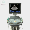 Siemens Acuson X300 Premium Edition Color Doppler (Refurbished) Ultrasound Machine