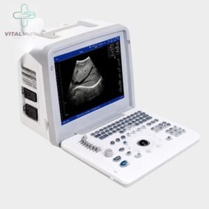 Apolo 7 Gray Scale (Brand New) Ultrasound Machine medical equipment Pakistan | VITAL MedTech
